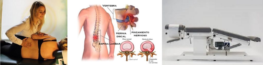 hernia